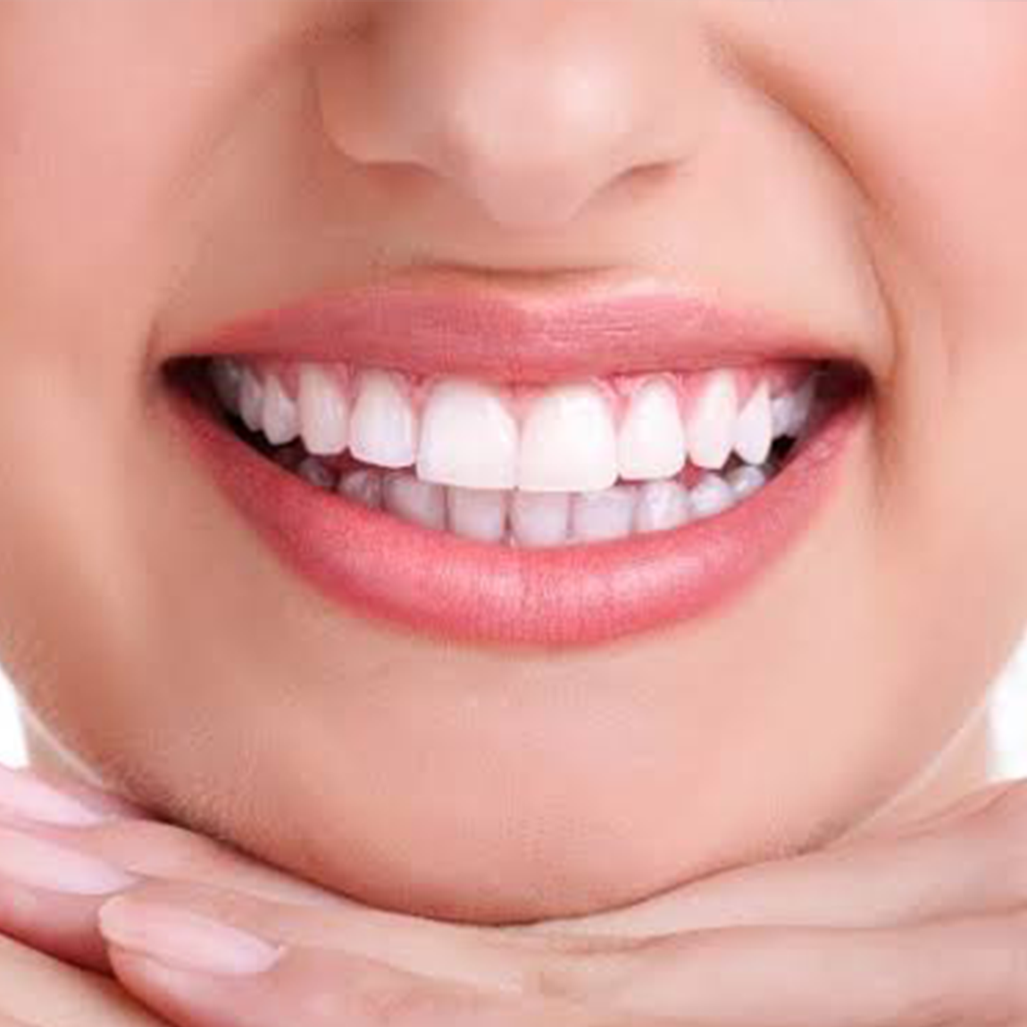 Hollywood Smile